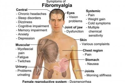 The Truth About Fibromyalgia