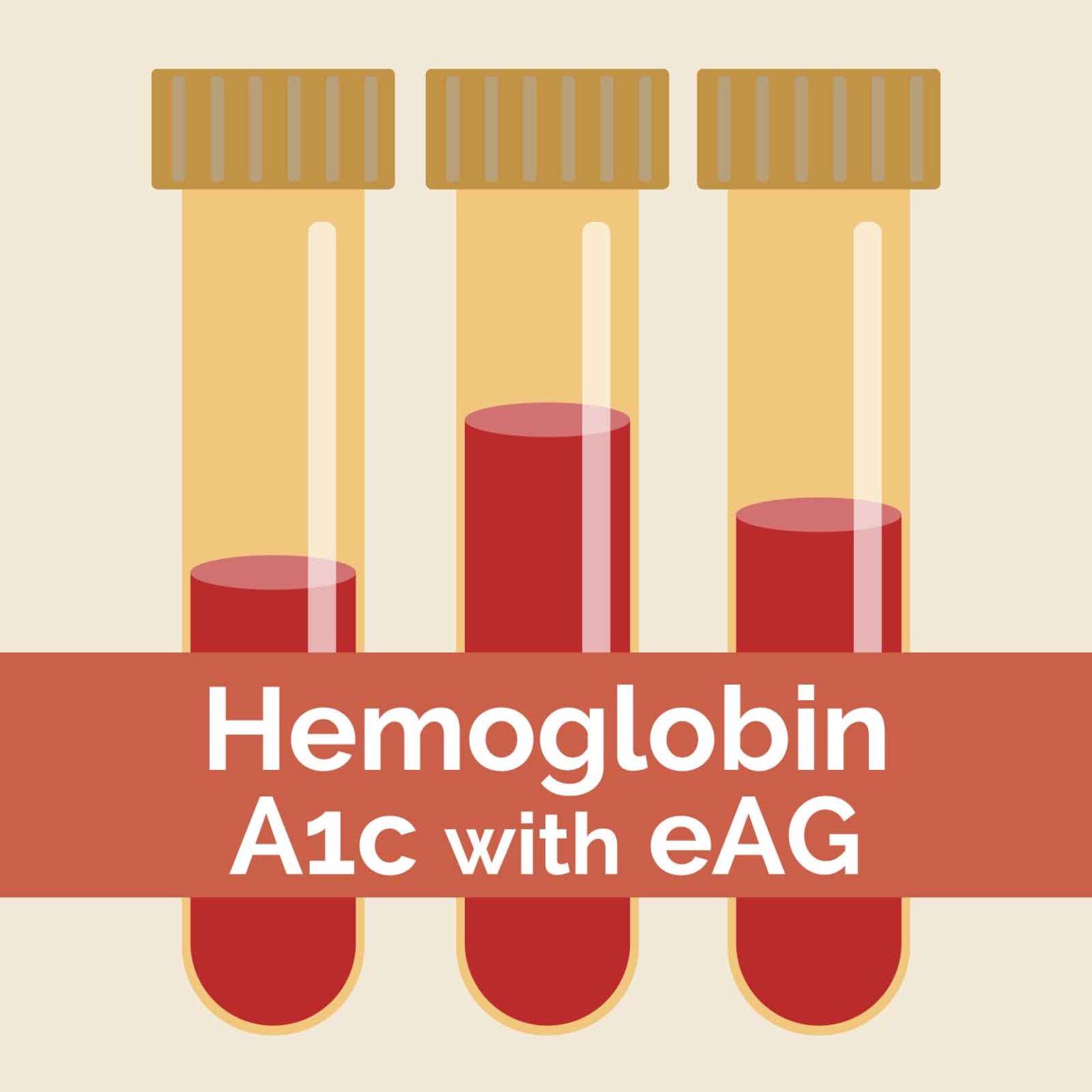 Hemoglobin a1c with eag dr keesha