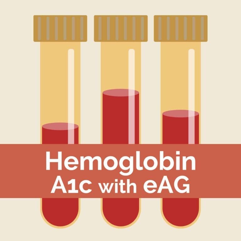 Hemoglobin a1c with eag dr keesha