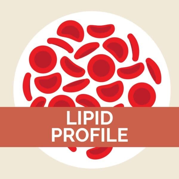 Lipid Profile